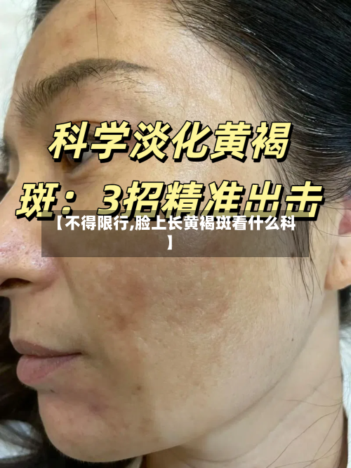 【不得限行,脸上长黄褐斑看什么科】-第3张图片
