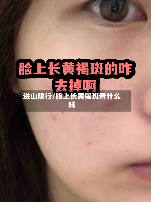 进山限行/脸上长黄褐斑看什么科